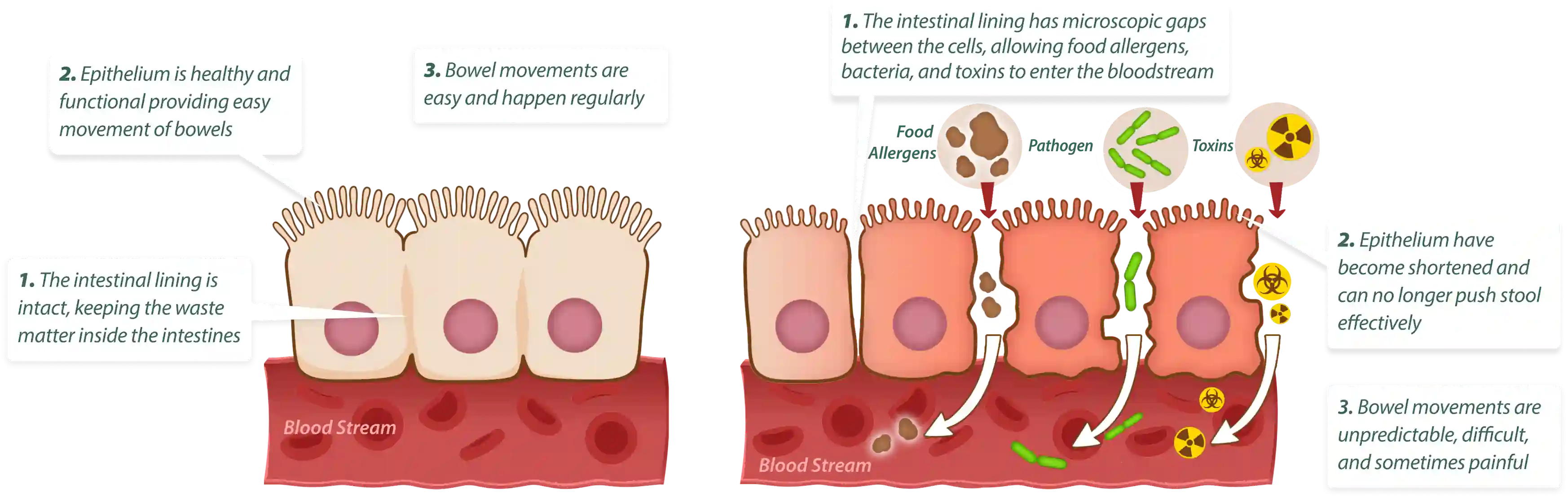 How EmaRelief works – 3-step gut cleansing and healing process