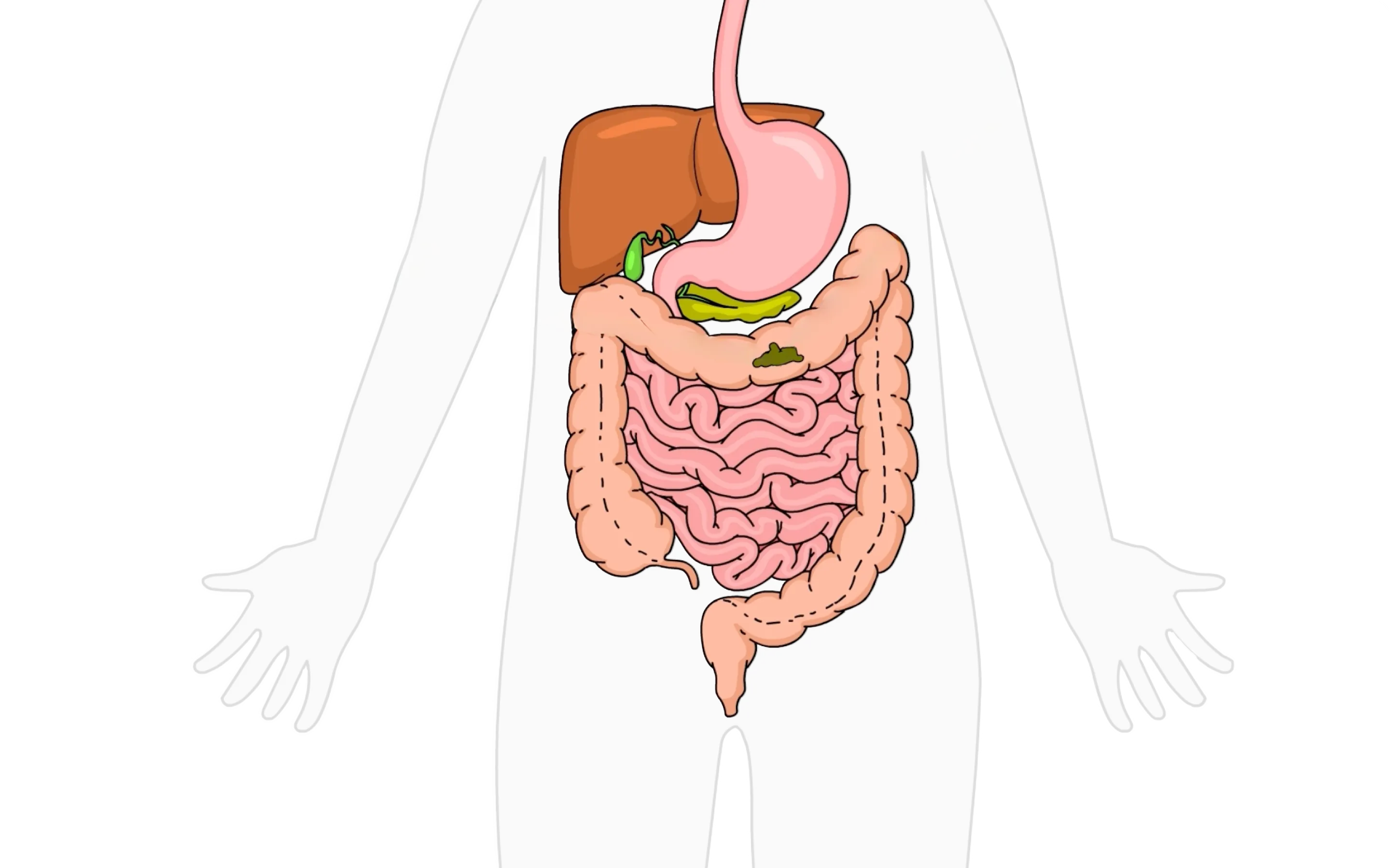 EmaRelief gut health video illustration