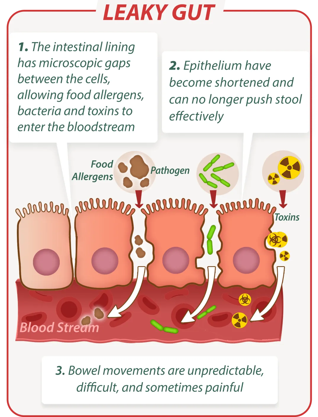 Leaky gut without EmaRelief – digestive issues illustration